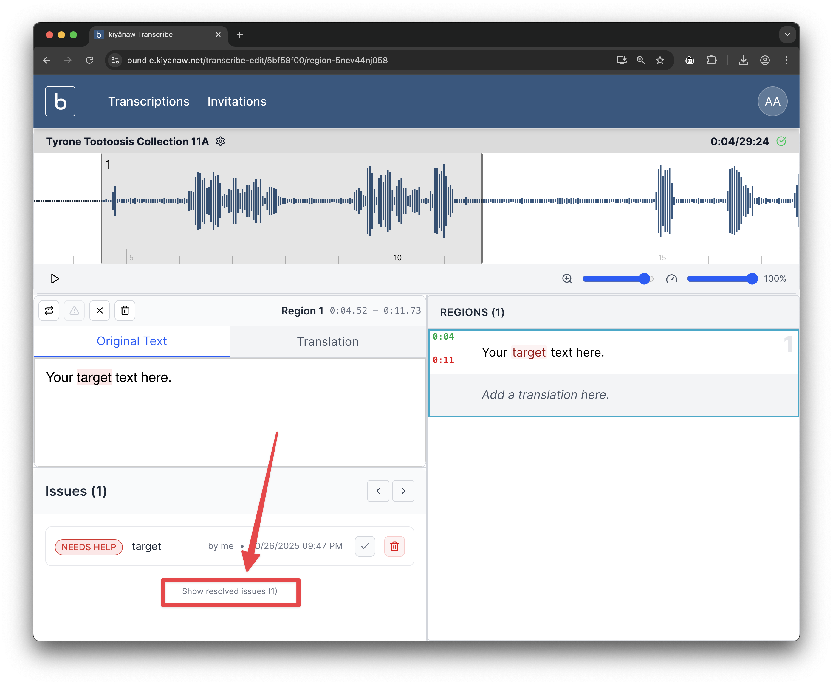 Show Resolved Issues
