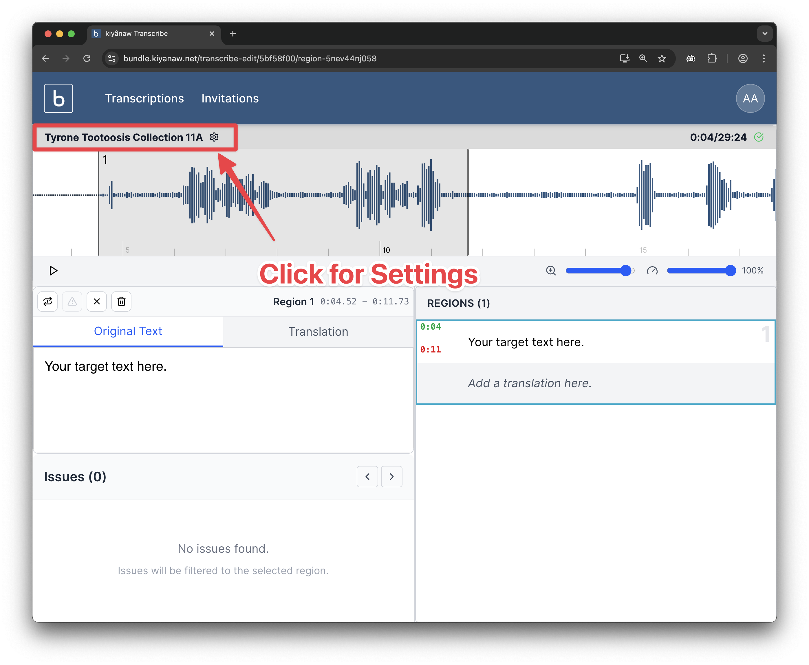 Transcription Settings
